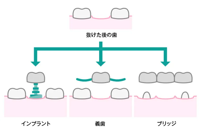 補綴治療