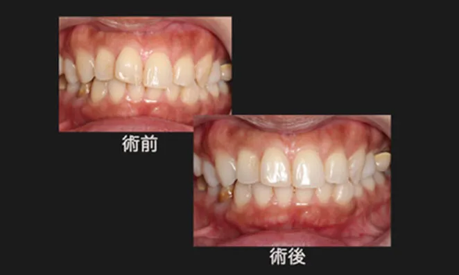 治療例3