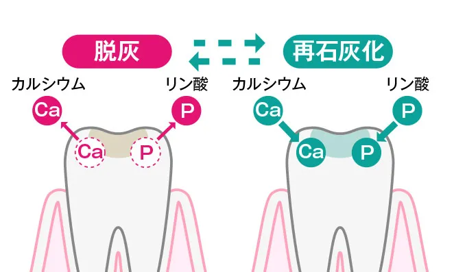 高濃度フッ素