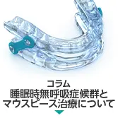 コラム｜睡眠時無呼吸症候群とマウスピース治療について