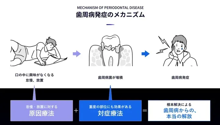 ブルーラジカルP-01で進化する歯周病治療：藤尾歯科医院の新たな