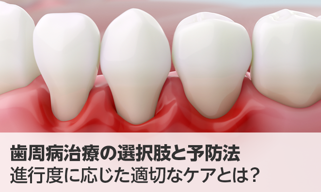 歯周病治療の選択肢と予防法｜進行度に応じた適切なケアとは？