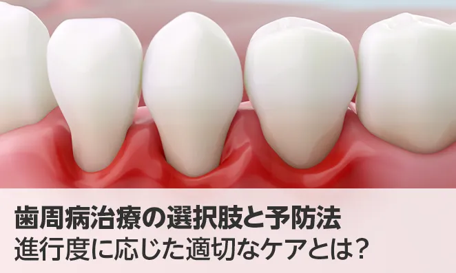 歯周病治療の選択肢と予防法|進行度に応じた適切なケアとは?
