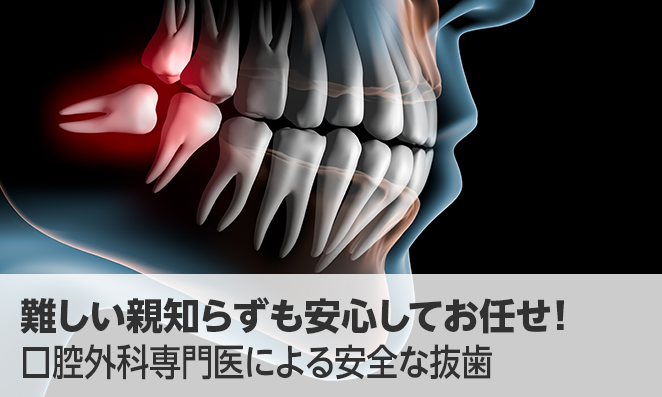 難しい親知らずも安心してお任せ!藤尾歯科医院の口腔外科専門医による安全な抜歯