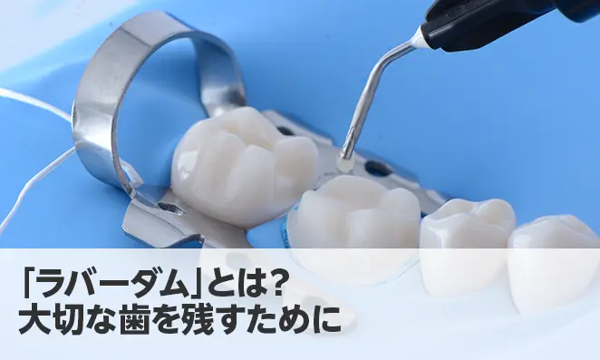 「ラバーダム」とは？大切な歯を残すために