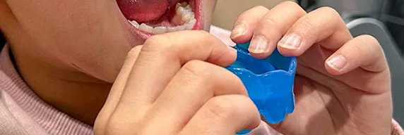 コラム：子どもの歯並びとプレオルソ